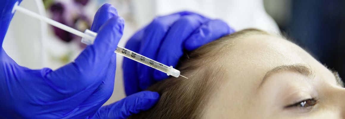 Haarausfall   Haarrevitalisierung   Eigenbluttherapie   PRP   Hautarzt Münster   Dermatologie PD Dr med Sabine Steinke