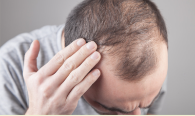 Haarausfall Münster   Was tun bei Haarausfall   Was hilft am besten gegen Haarausfall   Dermatologe   Hautarzt Münster   Behandlung