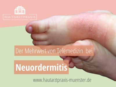 Hautarzt Münster Neurodermitis Telemedizin Teledermatologie Onlinedoctor Dermatotlogie Münster  PD Dr Steinke